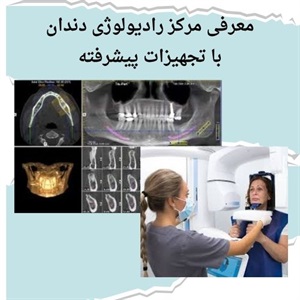 رادیولوژی دندان سعادت آباد چه کاربردهایی دارد؟